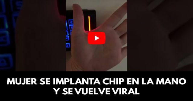 Mujer se implanta chip en la mano y se vuelve viral